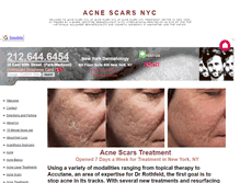 Tablet Screenshot of acnescarsnyc.net